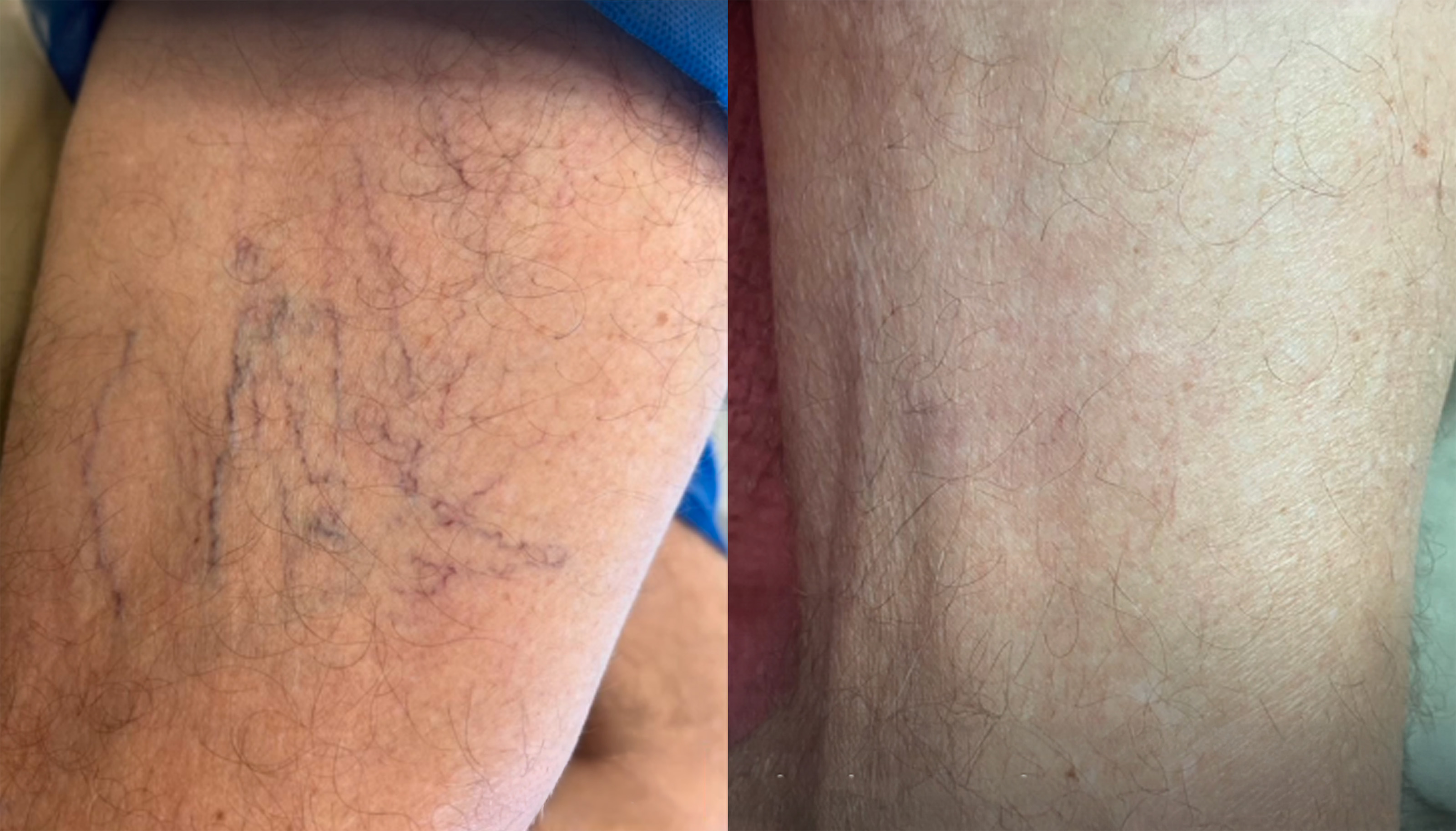 Caso 03 — Antes e Depois